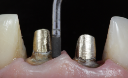 Grupo de máscara 72