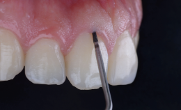 Grupo de máscara 73