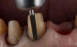 Grupo de máscara 74