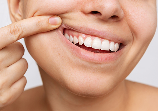 Cirurgias plásticas periodontais