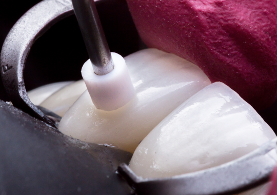 Cimentação de lamindados