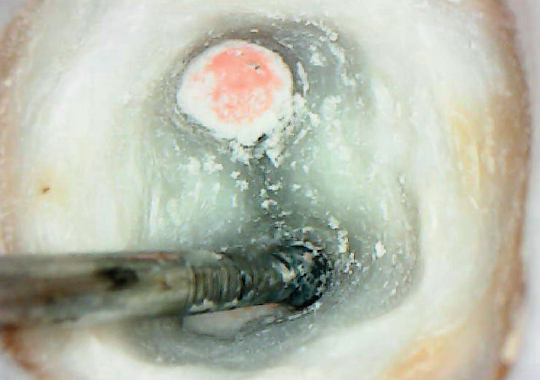 Tecnologia a favor da Endodontia