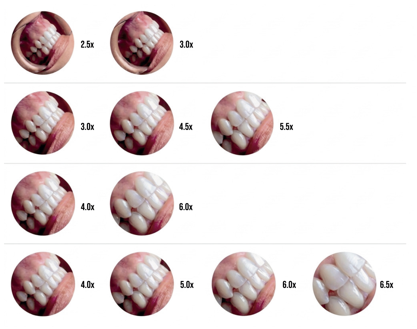 Comparativo de aumentos de lupa, de 2.5x a 6.5x