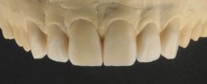 3-300x122
